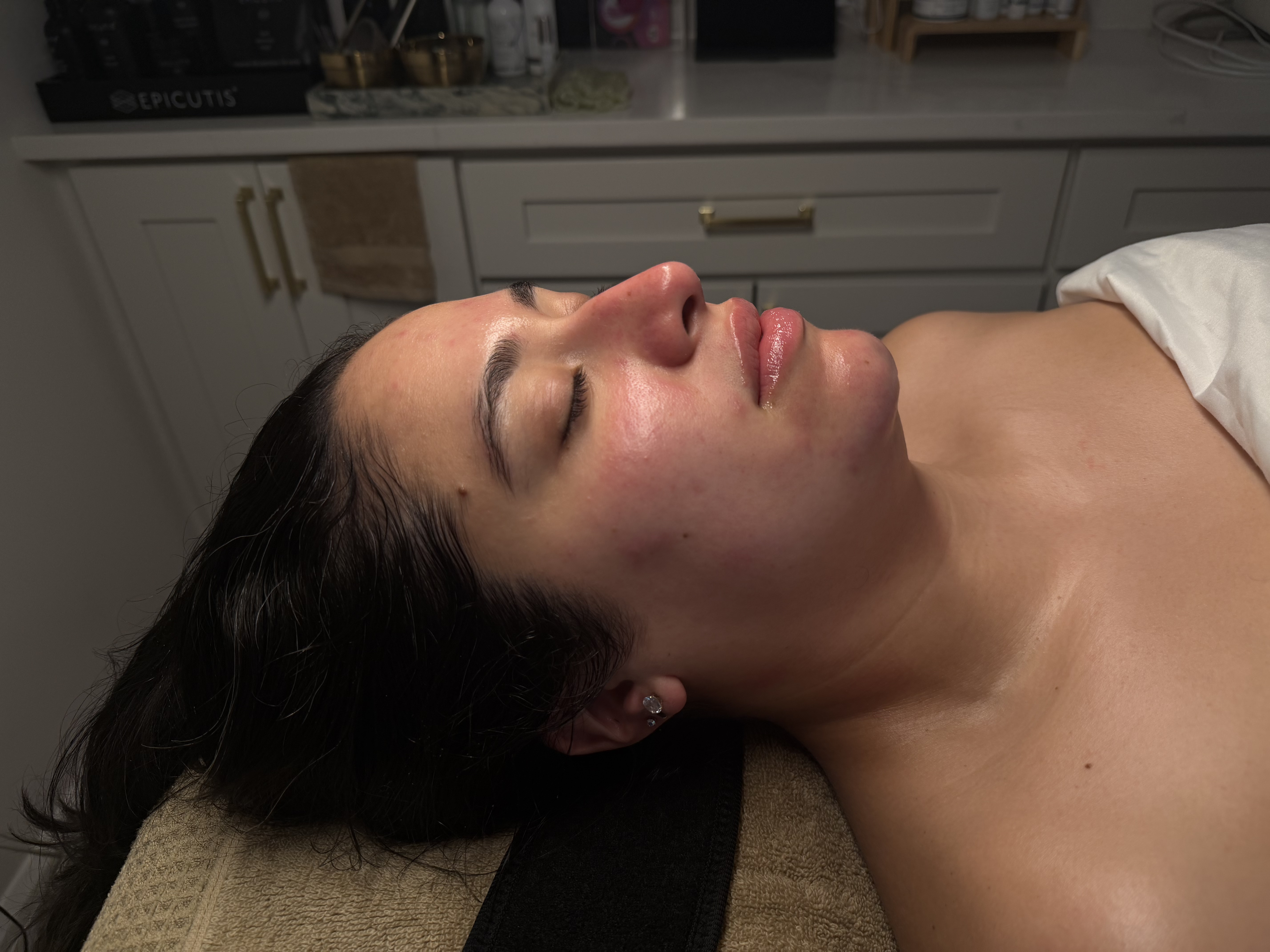 Advanced Treatments